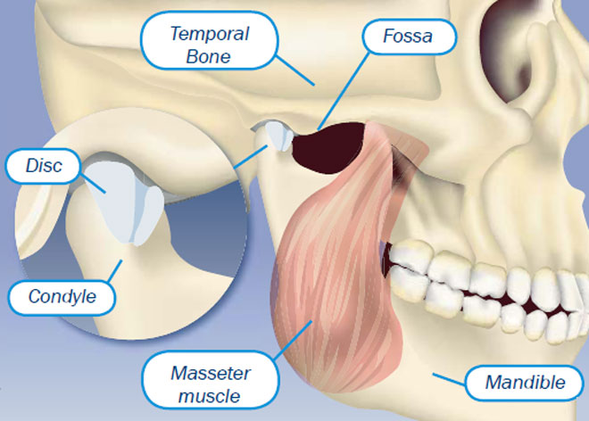 Study TMJ in Fibromyalgia and Chronic Fatigue Syndrome