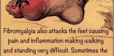 foot pain in fibromyalgia