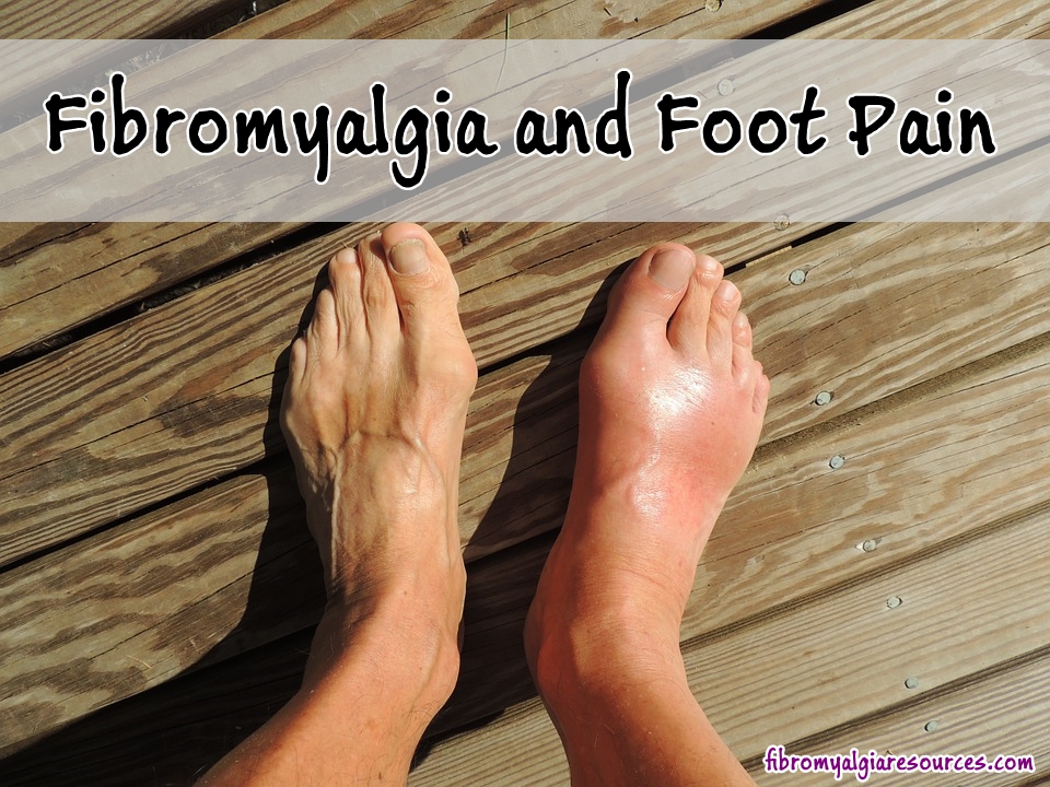 Controlling Fibromyalgia Foot Pain