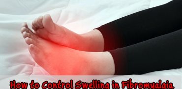 Control swelling in fibromyalgia