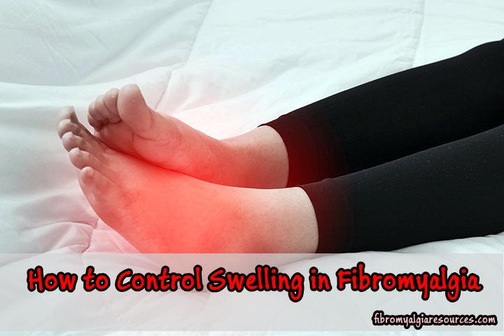 How to Control Swelling in Fibromyalgia