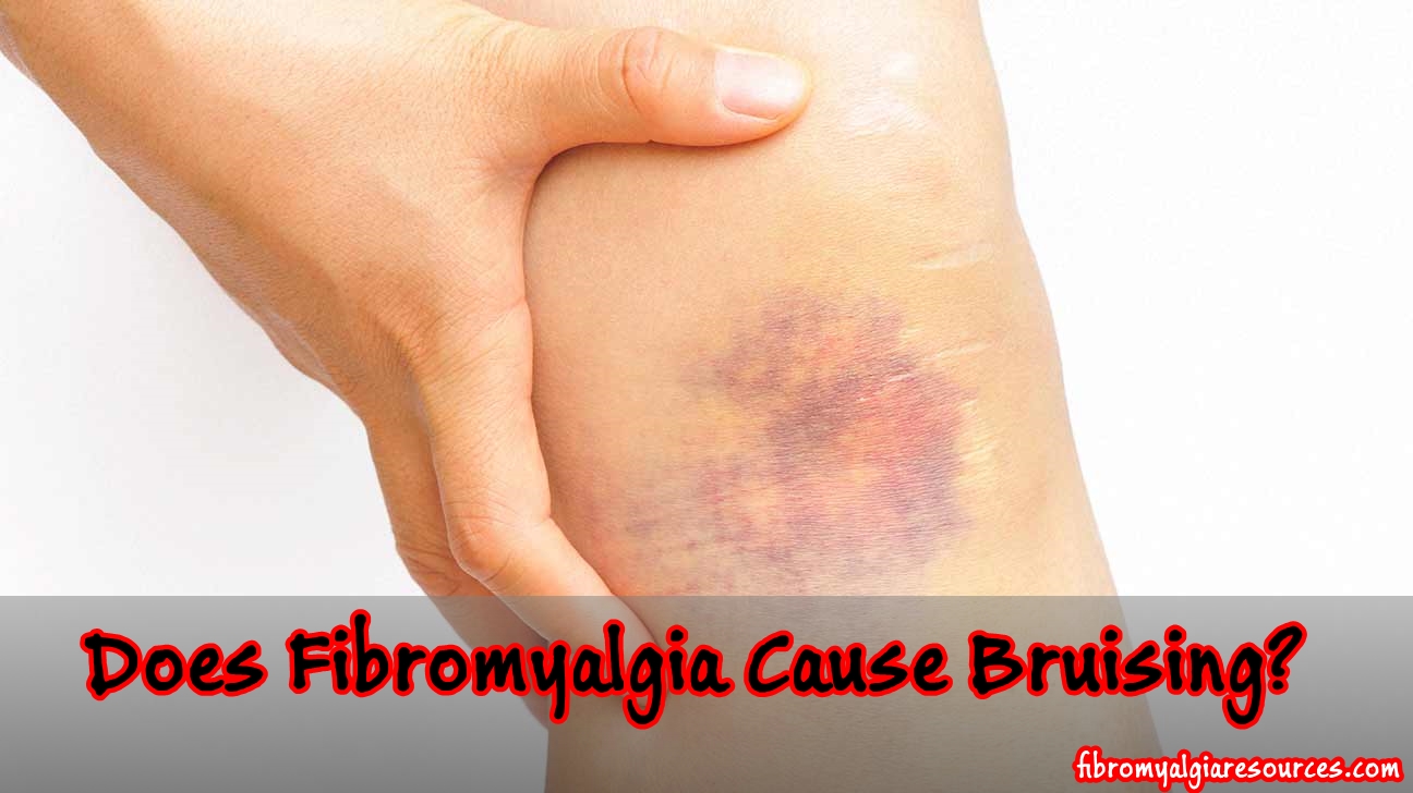 Fibromyalgia and Bruising: Effects of an invisible disease