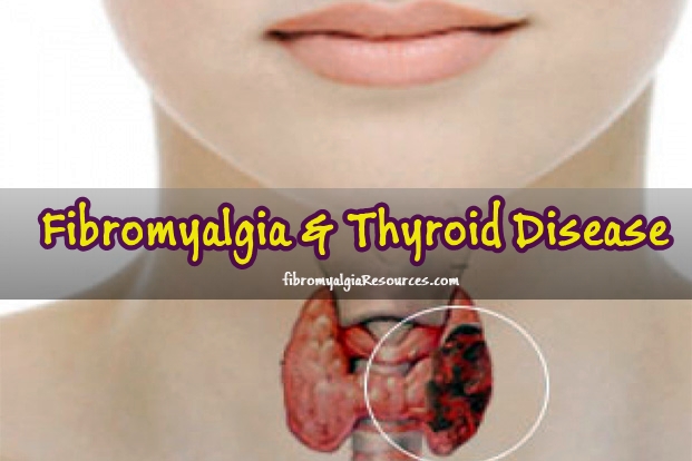 Fibromyalgia and the Thyroid disease