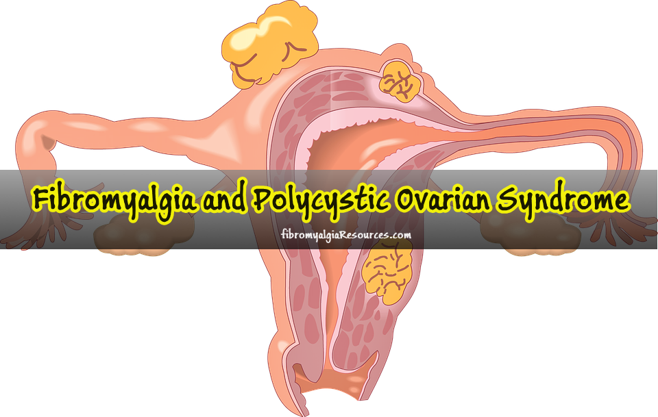 Fibromyalgia and Polycystic Ovarian Syndrome