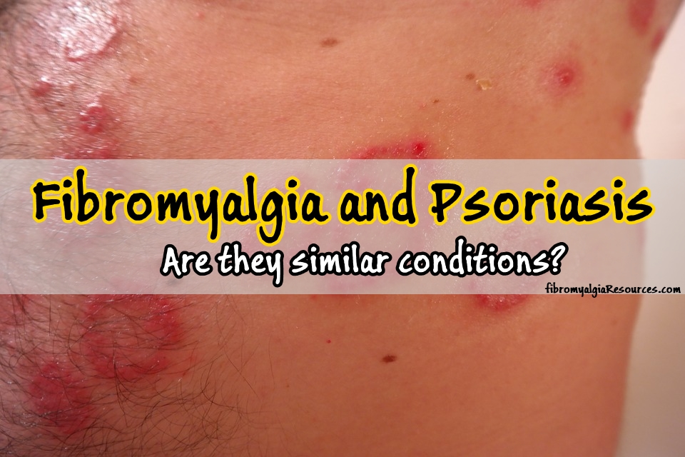 Fibromyalgia and Psoriasis. Are they similar conditions?