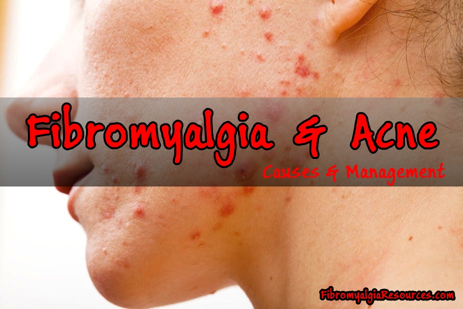 Acne – Does Fibromyalgia Causes Acne?