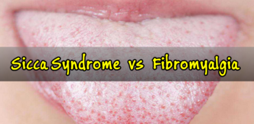 Sicca Syndrome? How it affects Fibromyalgia