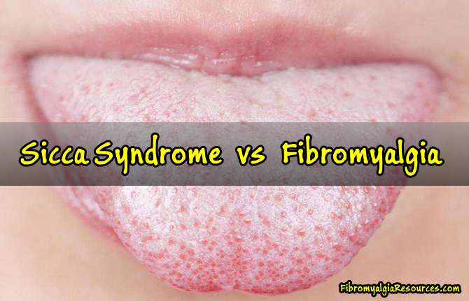 What is Sicca Syndrome? How it affects Fibromyalgia