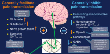 Norepinephrine in Fibromyalgia