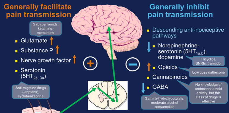 Norepinephrine in Fibromyalgia