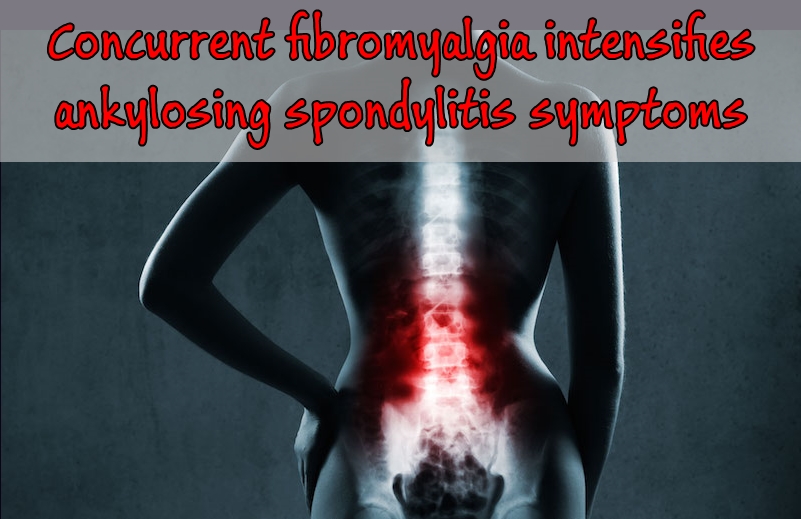 Fibromyalgia Intensifies Ankylosing Spondylitis Symptoms