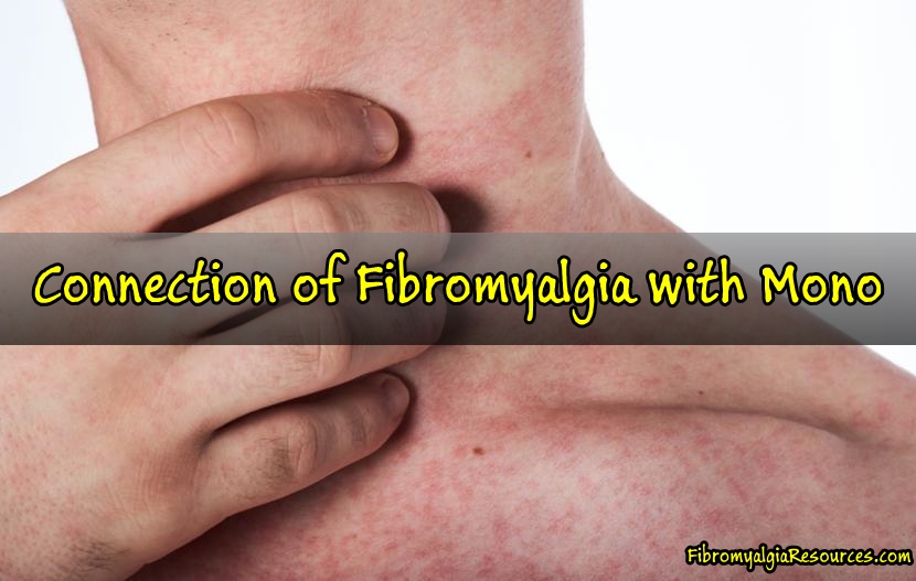 Connection of Fibromyalgia with Infectious Mononucleosis