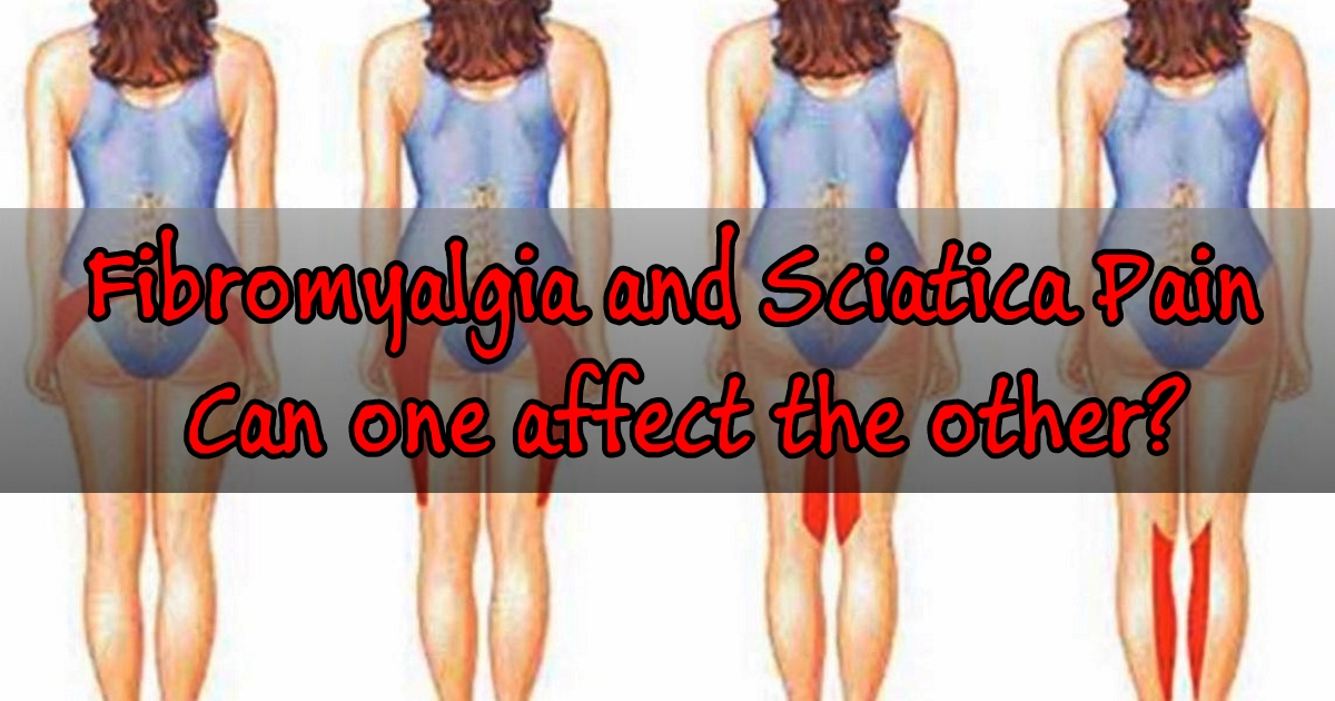 Fibromyalgia and Sciatica Pain – Can one affect the other?