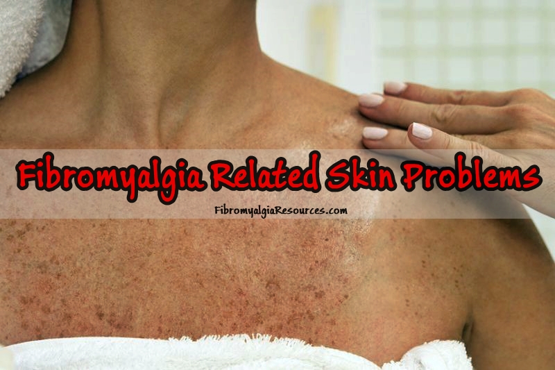 Fibromyalgia Related Skin Problems and their Managment