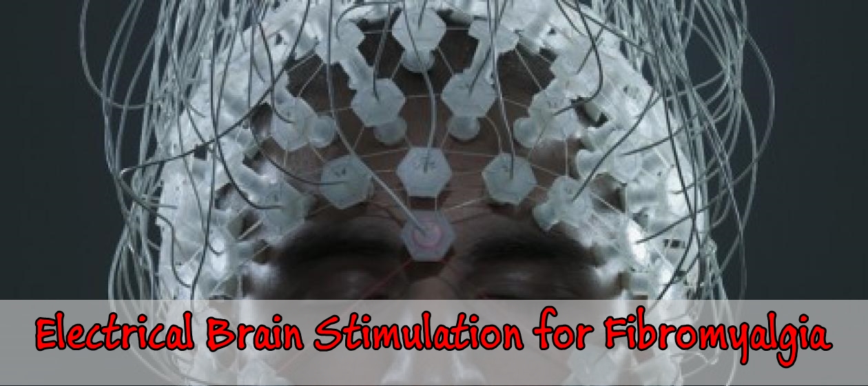 Electrical Brain Stimulation for Fibromyalgia