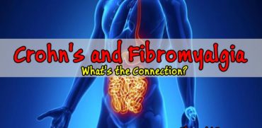 Crohn's and Fibromyalgia: What's the Connection?