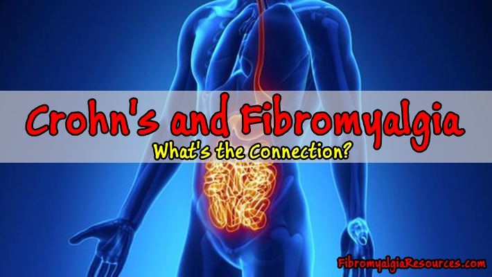 Crohn’s and Fibromyalgia: What’s the Connection?