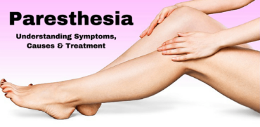 paresthesia fibromyalgia