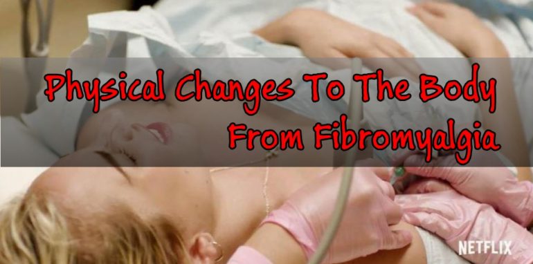 Physical Changes To The Body From Fibromyalgia