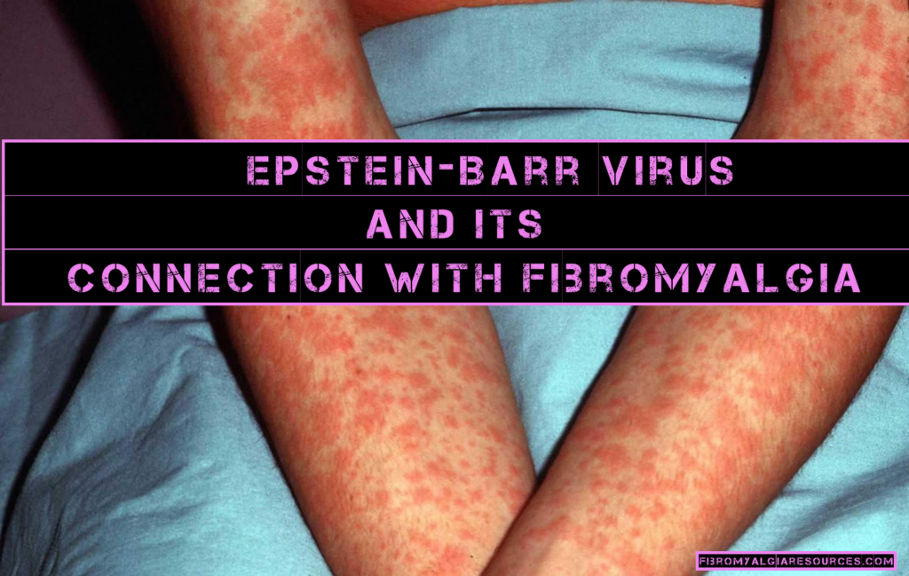 EBV Is The Possible Cause Of Fibromyalgia Research Fibromyalgia 