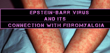 EBV Is The Possible Cause Of Fibromyalgia, Research