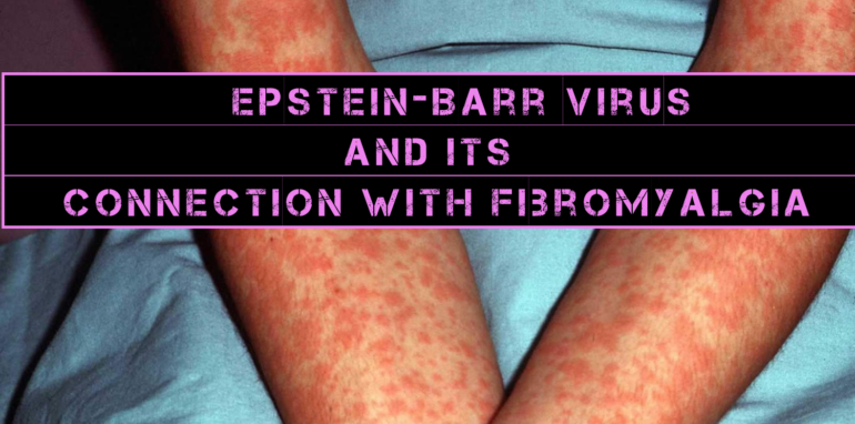 EBV Is The Possible Cause Of Fibromyalgia, Research