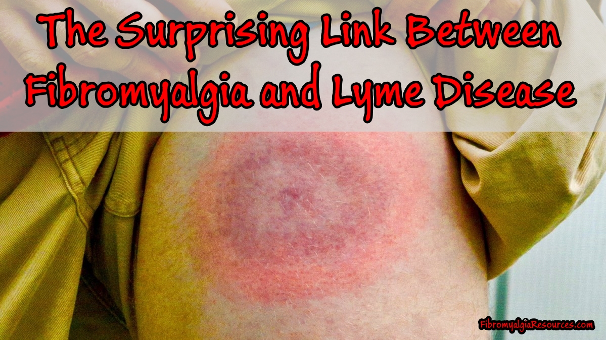 The Surprising Link Between Fibromyalgia and Lyme Disease