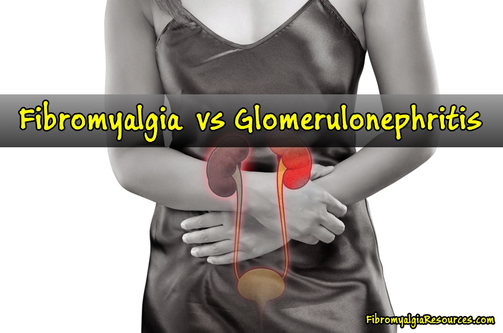 Can Fibromyalgia Leads to Glomerulonephritis?