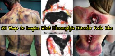 Ways to Imagine What Fibromyalgia Disorder Feels Like