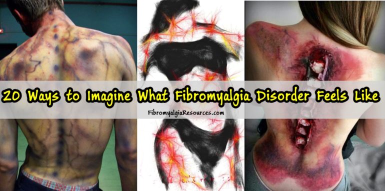 Ways to Imagine What Fibromyalgia Disorder Feels Like