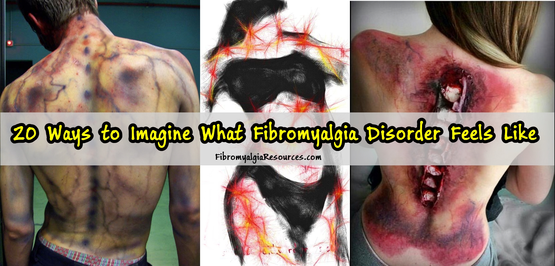 Ways to Imagine What Fibromyalgia Disorder Feels Like