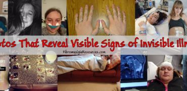 Photos that Reveals the Visible Aspect of "Invisible" illness