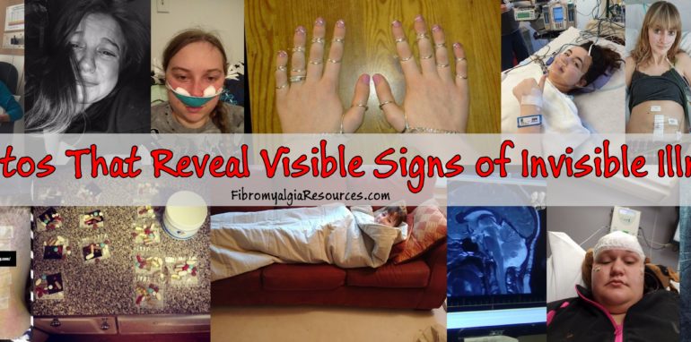 Photos that Reveals the Visible Aspect of "Invisible" illness